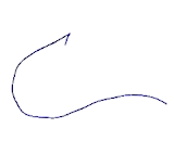 SET Binding Protein 1 (SETBP1)