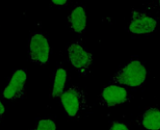 Sertoli Cells (SEC)