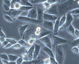 Small-cell Lung Carcinomar Cells (SCLC)