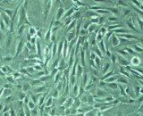 Splenic Fibroblasts (SF)