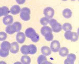 T Lymphocytes (TL)