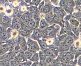 Embryonal Carcinoma Cells (EC)