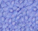 Tracheal Epithelial Cells (TEC)