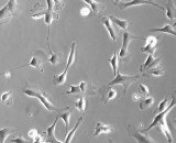 Tracheal Smooth Muscle Cells (TSMC)