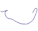 Translocase Of Outer Mitochondrial Membrane 40 (TOMM40)