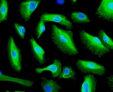 Urethral Epithelial Cells (UrEC)