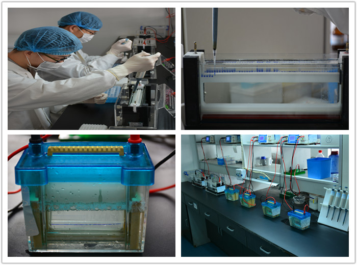 Protein Electrophoresis Experiment