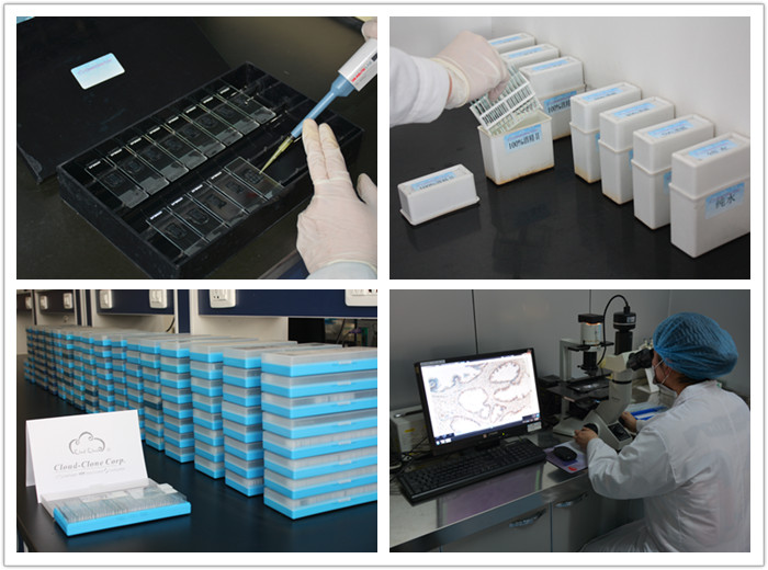 Immunohistochemistry Experiment (IHC)