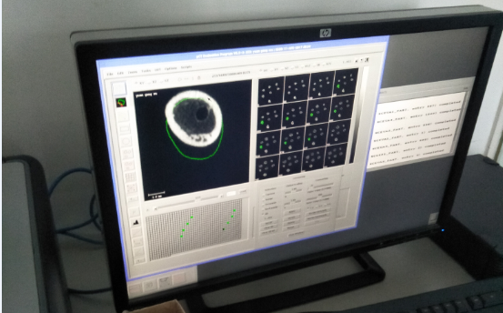 Micro CT is used to shoot bone tissue