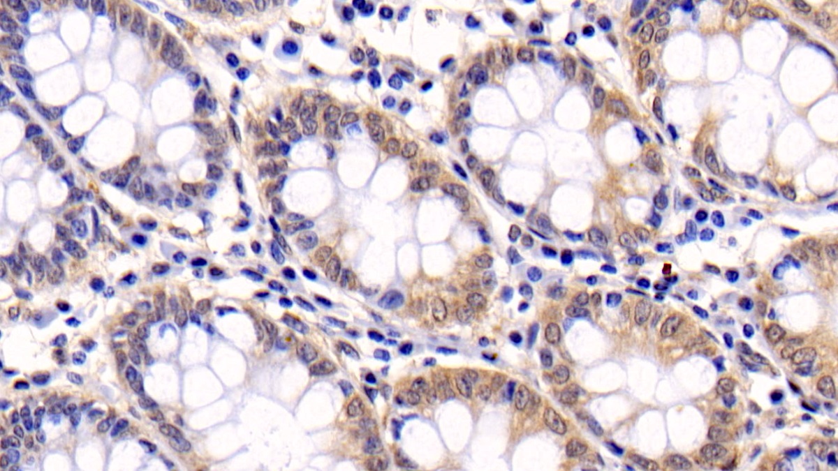 Anti-Extracellular Signal Regulated Kinase 1 (ERK1) Monoclonal Antibody