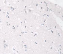 Anti-Lamin B1 (LMNB1) Polyclonal Antibody