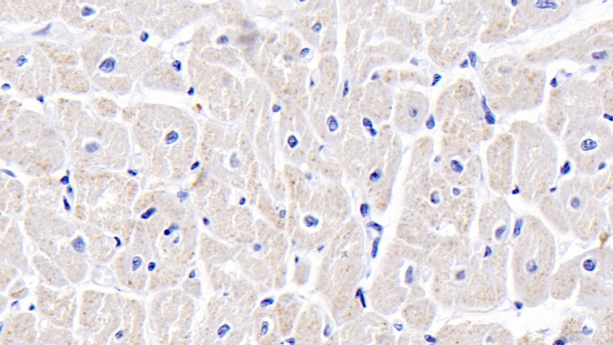 Anti-Voltage Dependent Anion Channel Protein 1 (VDAC1) Polyclonal Antibody