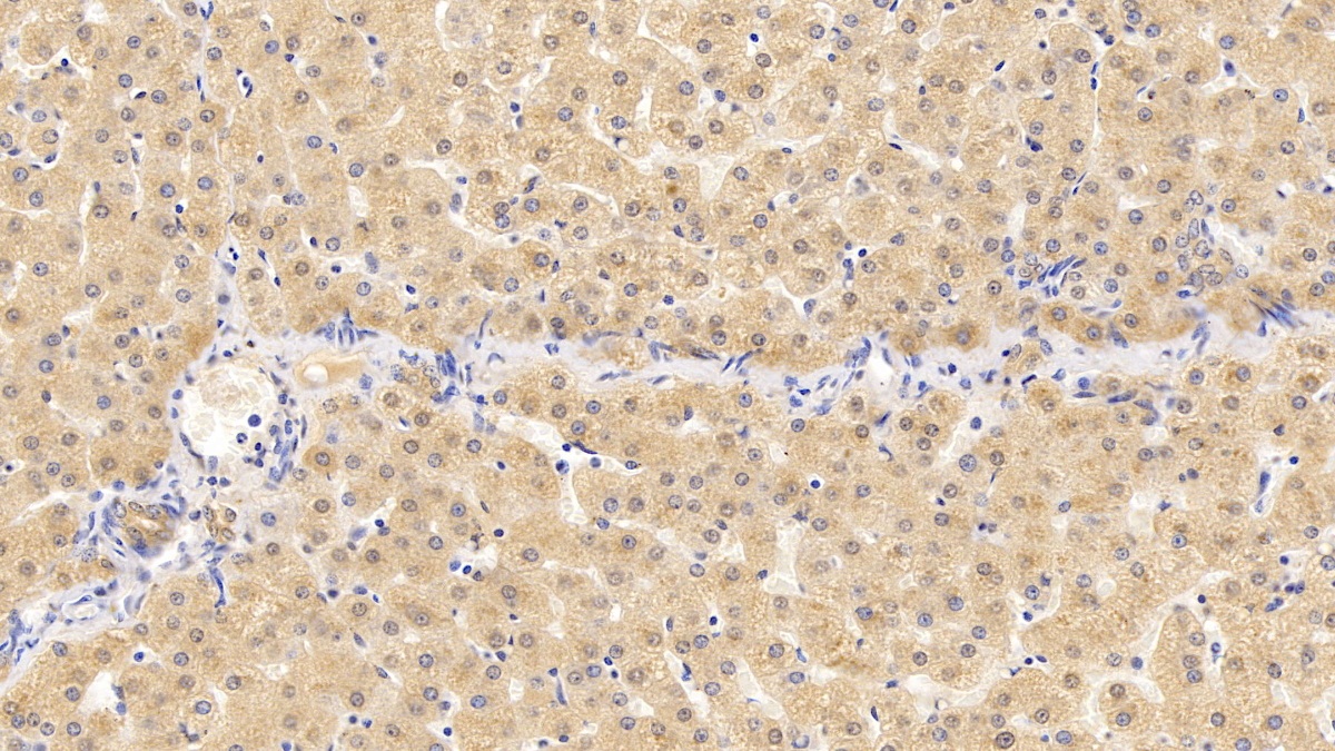 Anti-Voltage Dependent Anion Channel Protein 1 (VDAC1) Monoclonal Antibody