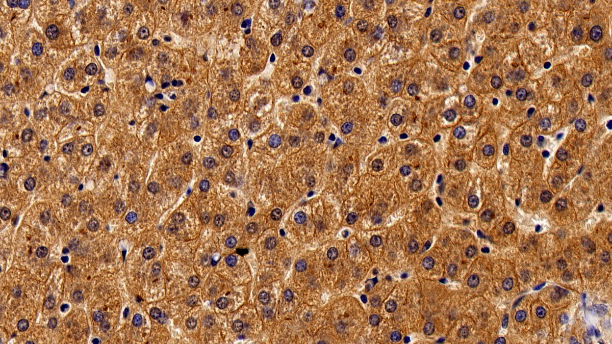 Monoclonal Antibody to Activated Leukocyte Cell Adhesion Molecule (ALCAM)