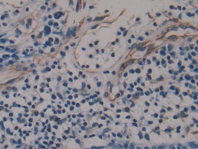 Monoclonal Antibody to Amphiregulin (AREG)