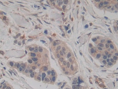 Monoclonal Antibody to Amphiregulin (AREG)