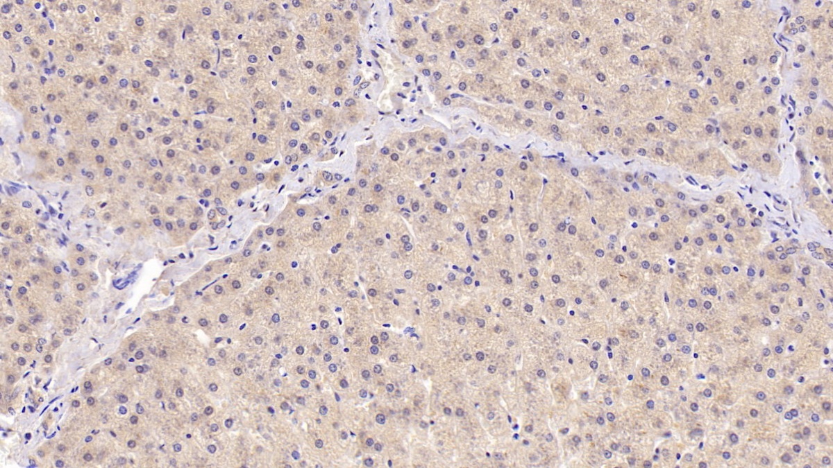 Monoclonal Antibody to Angiogenin (ANG)