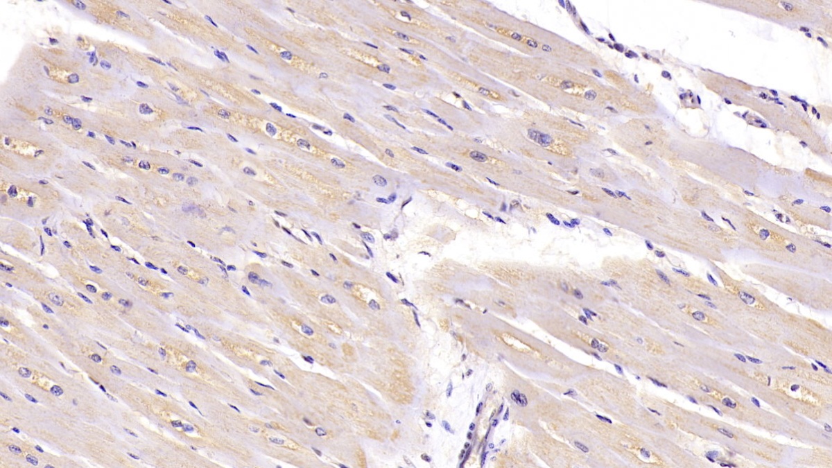 Monoclonal Antibody to Connective Tissue Growth Factor (CTGF)