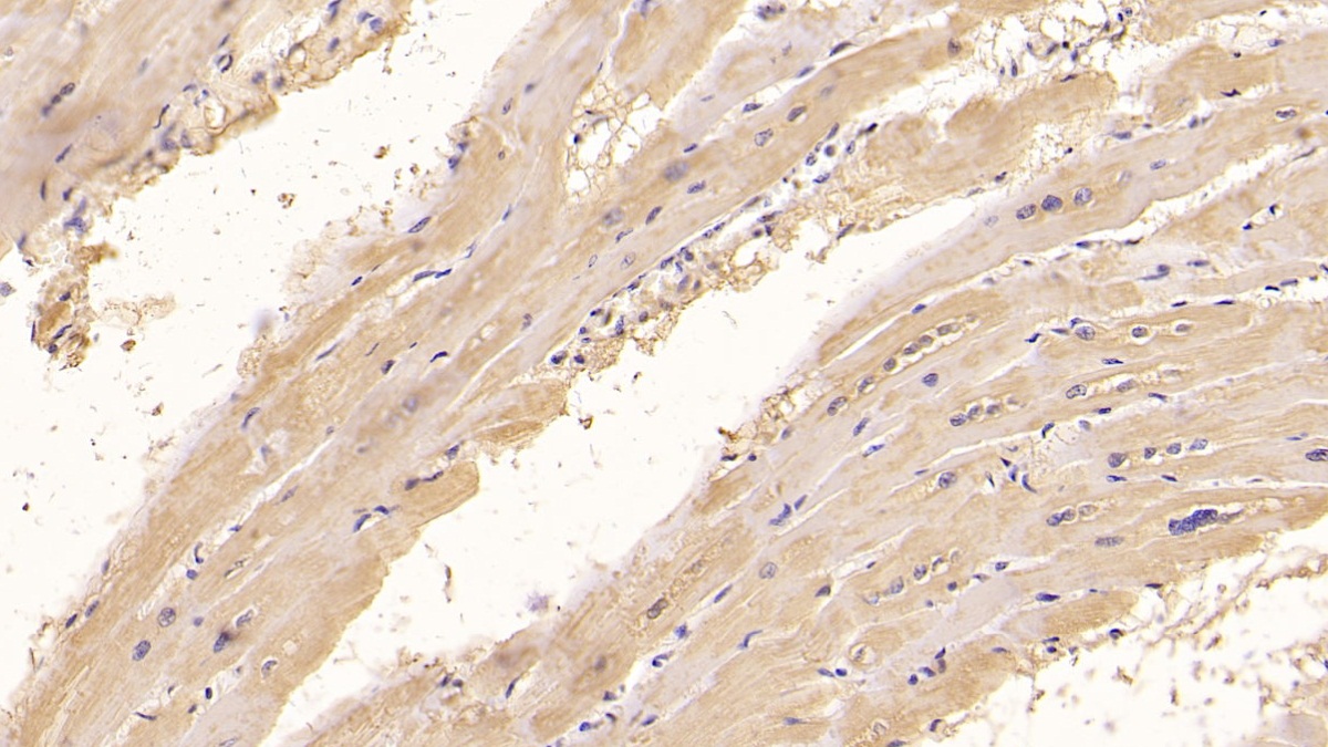 Monoclonal Antibody to Connective Tissue Growth Factor (CTGF)