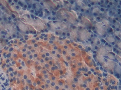 Monoclonal Antibody to Connective Tissue Growth Factor (CTGF)