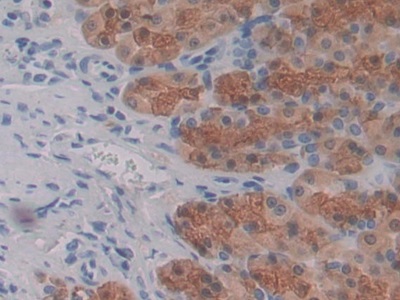 Monoclonal Antibody to Connective Tissue Growth Factor (CTGF)