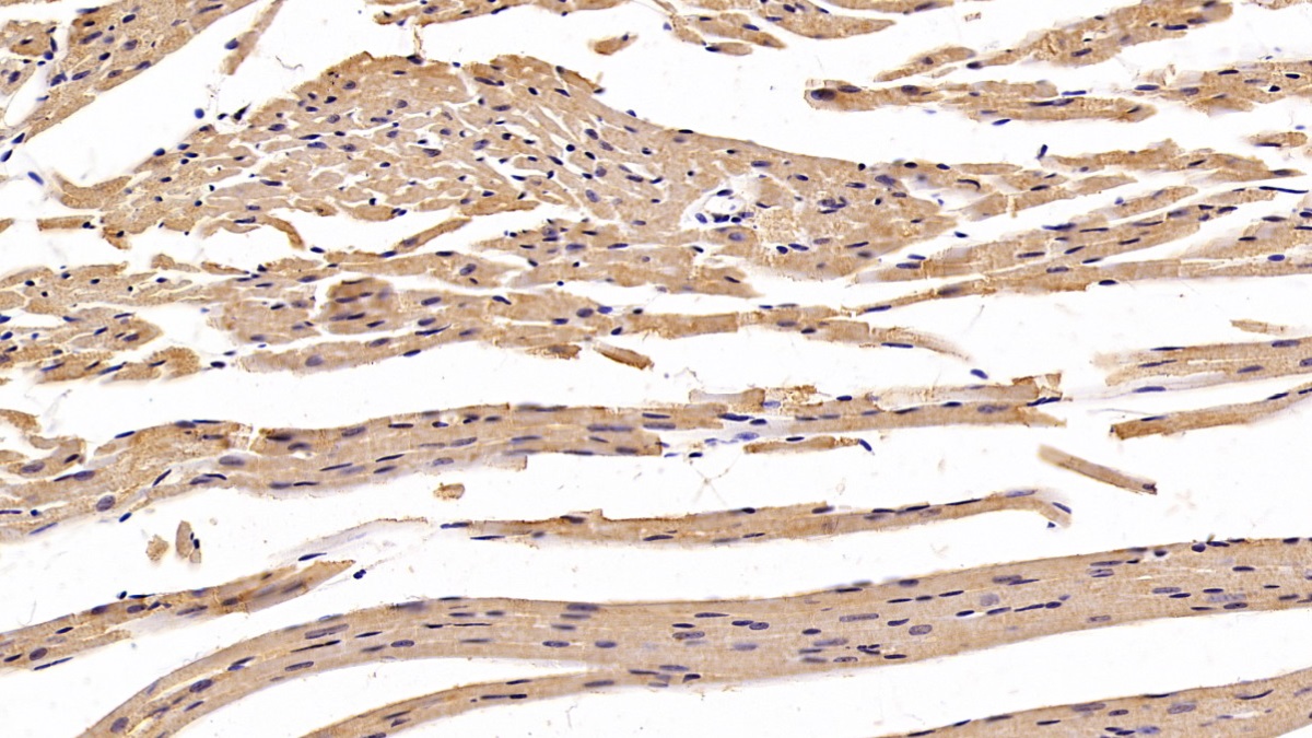 Monoclonal Antibody to Erythropoietin Receptor (EPOR)