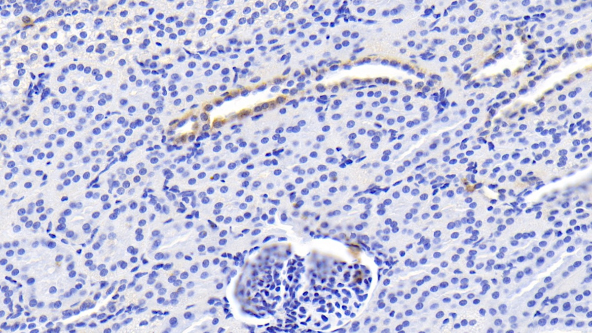 Monoclonal Antibody to Erythropoietin (EPO)