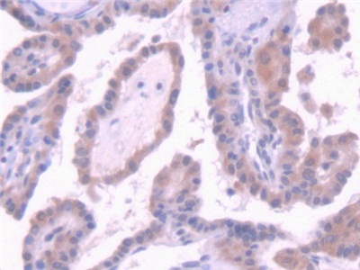 Monoclonal Antibody to Erythropoietin (EPO)