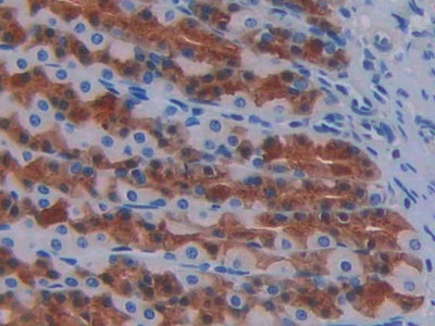 Monoclonal Antibody to Fibroblast Growth Factor 1, Acidic (FGF1)