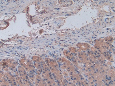 Monoclonal Antibody to Chemokine (C-X-C Motif) Ligand 1 (CXCL1)