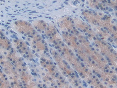 Monoclonal Antibody to Chemokine (C-X-C Motif) Ligand 1 (CXCL1)