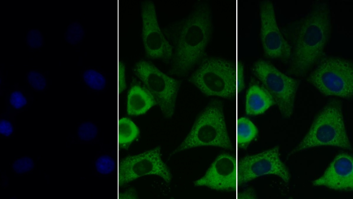 Monoclonal Antibody to Insulin Like Growth Factor 1 (IGF1)