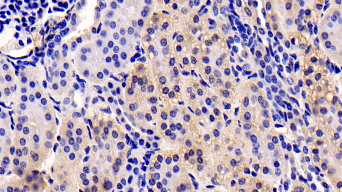 Monoclonal Antibody to Insulin Like Growth Factor 1 (IGF1)