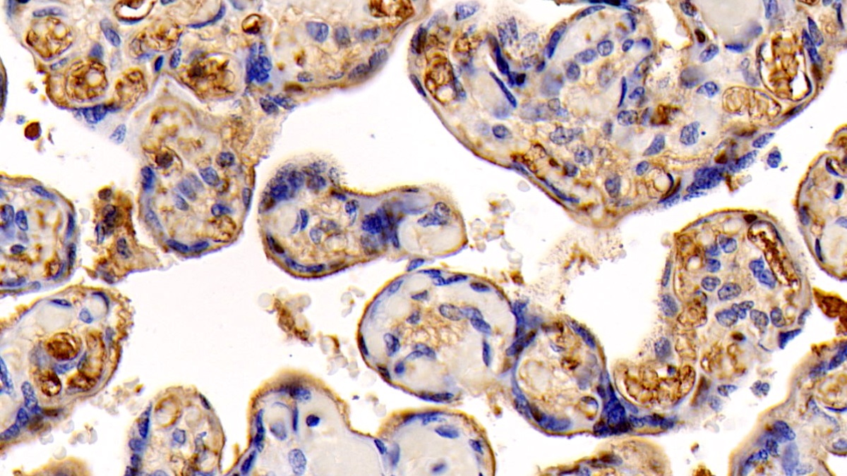 Monoclonal Antibody to Insulin Like Growth Factor 1 (IGF1)