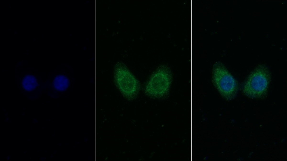 Monoclonal Antibody to Insulin Like Growth Factor 1 (IGF1)