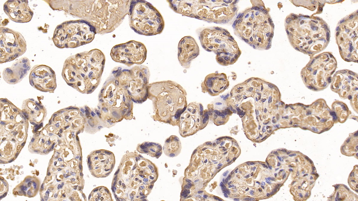 Monoclonal Antibody to Insulin Like Growth Factor Binding Protein 1 (IGFBP1)