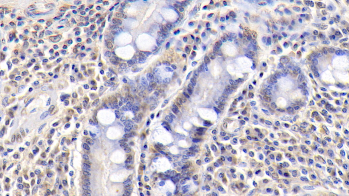 Monoclonal Antibody to Insulin Like Growth Factor Binding Protein 3 (IGFBP3)