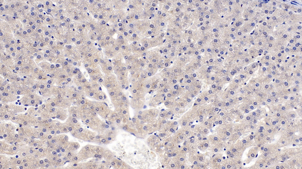 Monoclonal Antibody to Insulin Like Growth Factor Binding Protein 4 (IGFBP4)