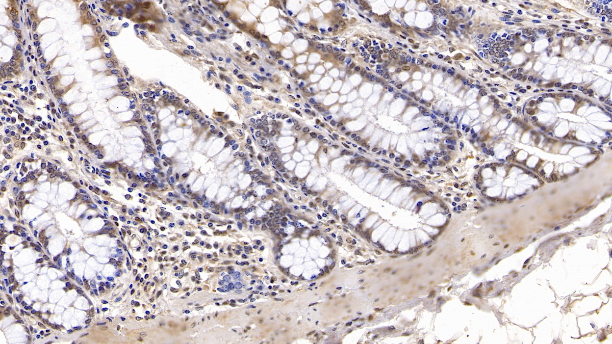 Monoclonal Antibody to Insulin Like Growth Factor Binding Protein 4 (IGFBP4)