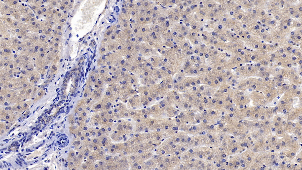 Monoclonal Antibody to Insulin Like Growth Factor Binding Protein 4 (IGFBP4)