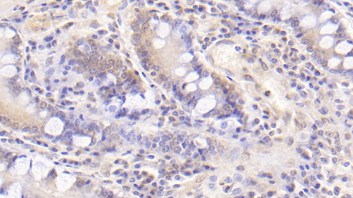 Monoclonal Antibody to Interleukin 10 (IL10)