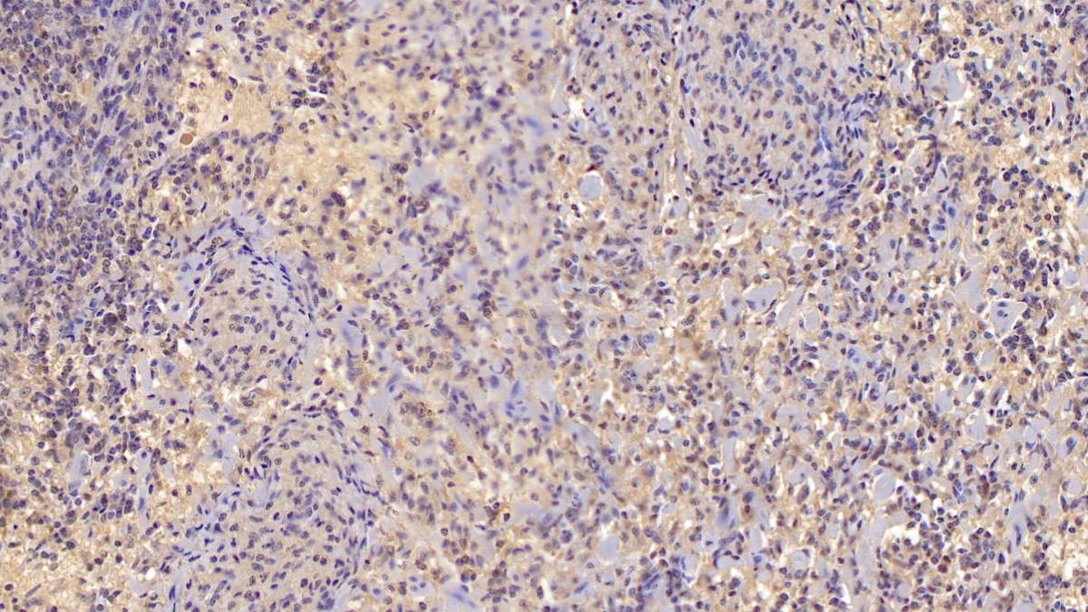 Monoclonal Antibody to Interleukin 10 (IL10)