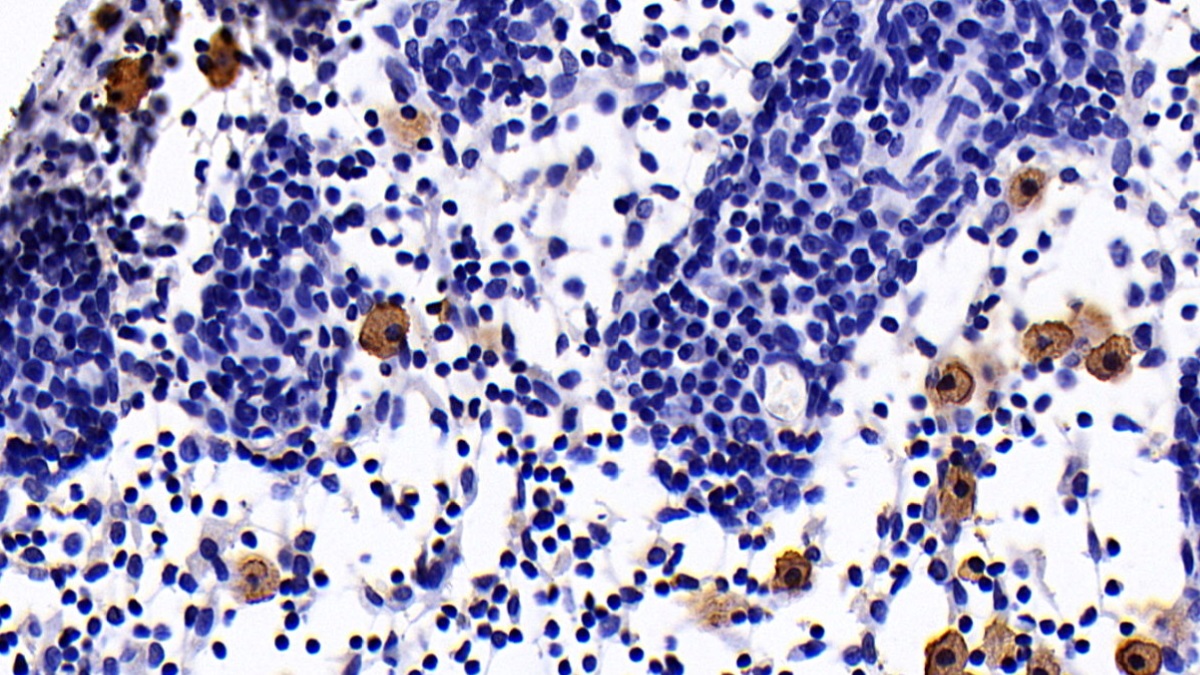 Monoclonal Antibody to Interleukin 10 (IL10)