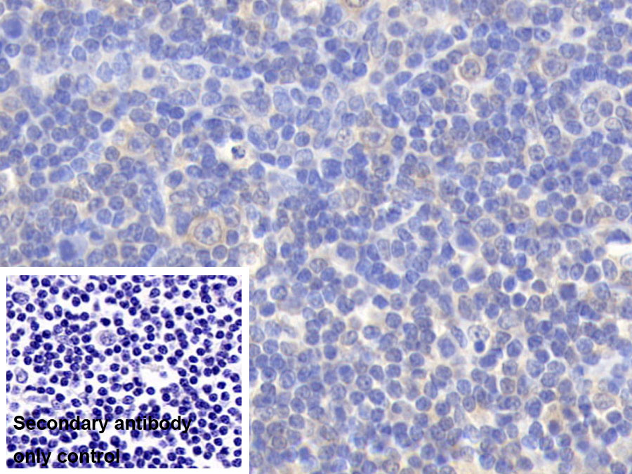 Monoclonal Antibody to Interleukin 12B (IL12B)