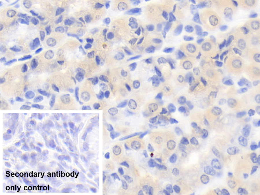 Monoclonal Antibody to Interleukin 12B (IL12B)