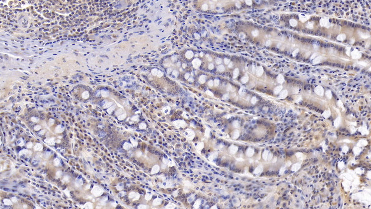 Monoclonal Antibody to Interleukin 17 (IL17)