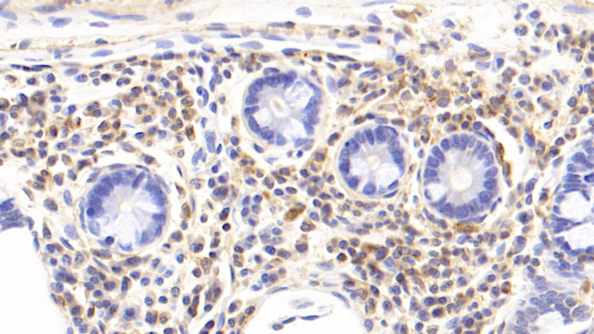 Monoclonal Antibody to Interleukin 17 (IL17)