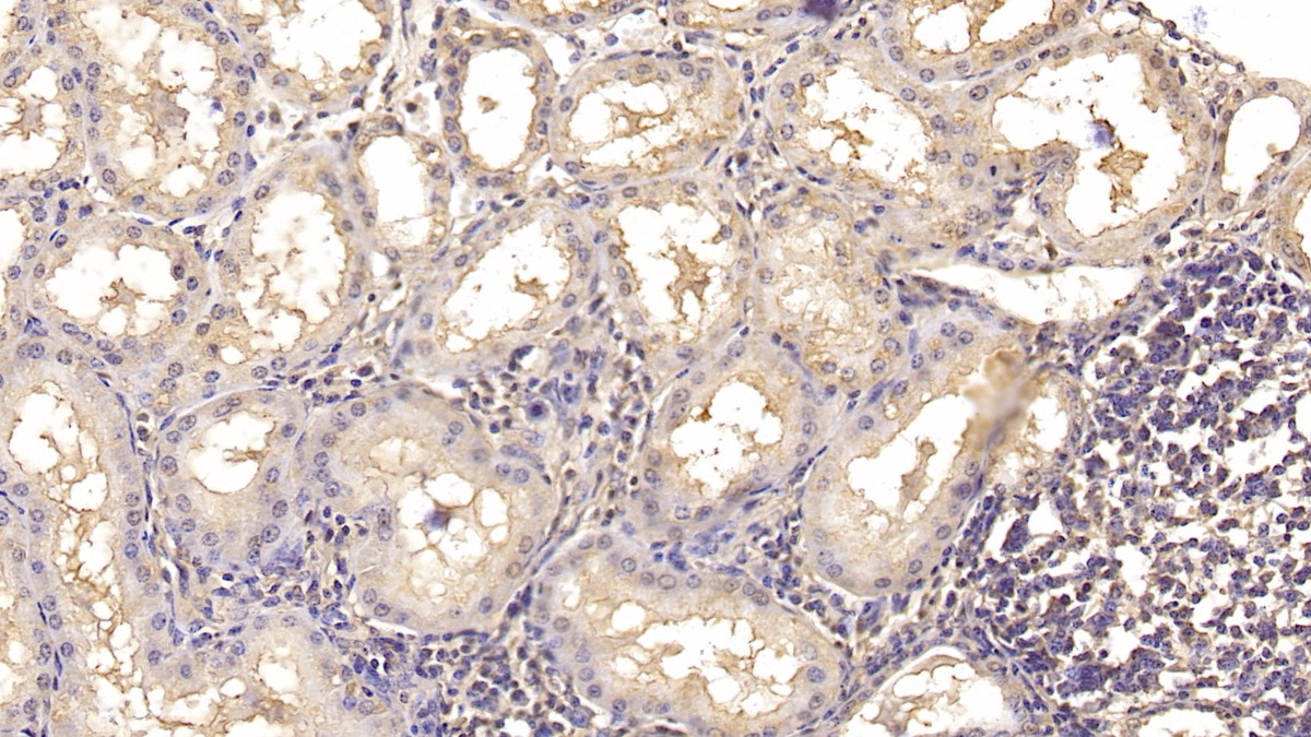 Monoclonal Antibody to Interleukin 18 (IL18)