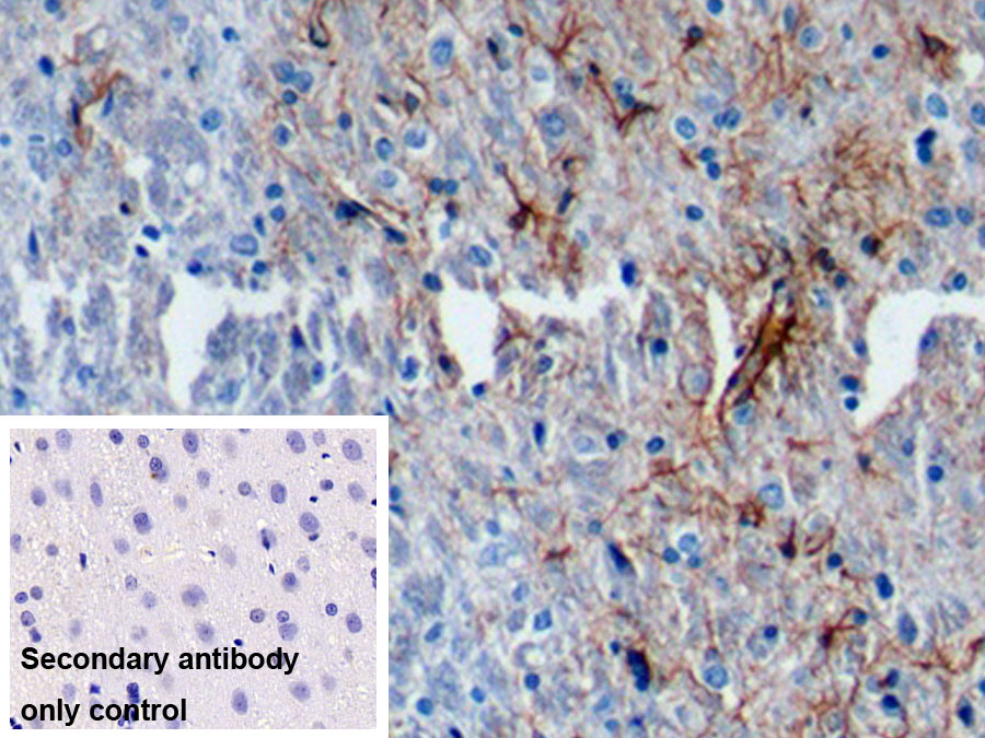 Monoclonal Antibody to Glial Fibrillary Acidic Protein (GFAP)