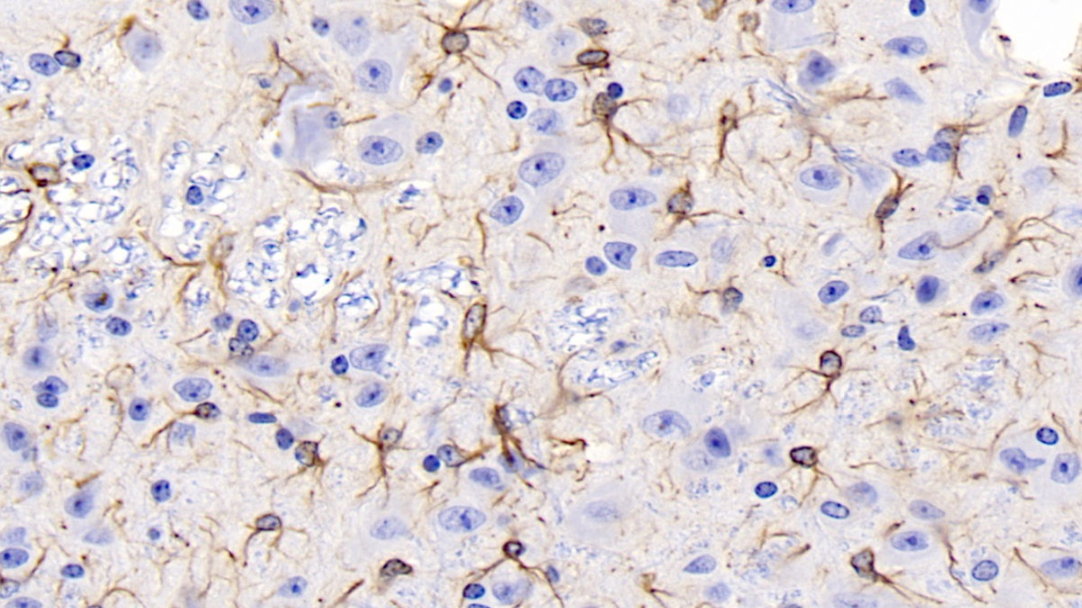 Monoclonal Antibody to Glial Fibrillary Acidic Protein (GFAP)